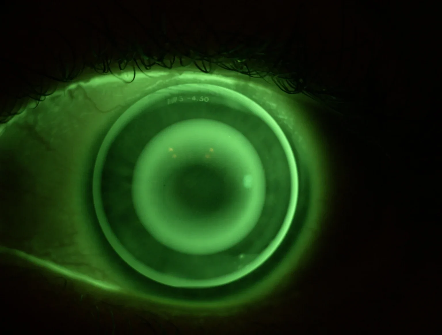 Ortocheratologia - ottica a mezzolombardo - ottica foto tait