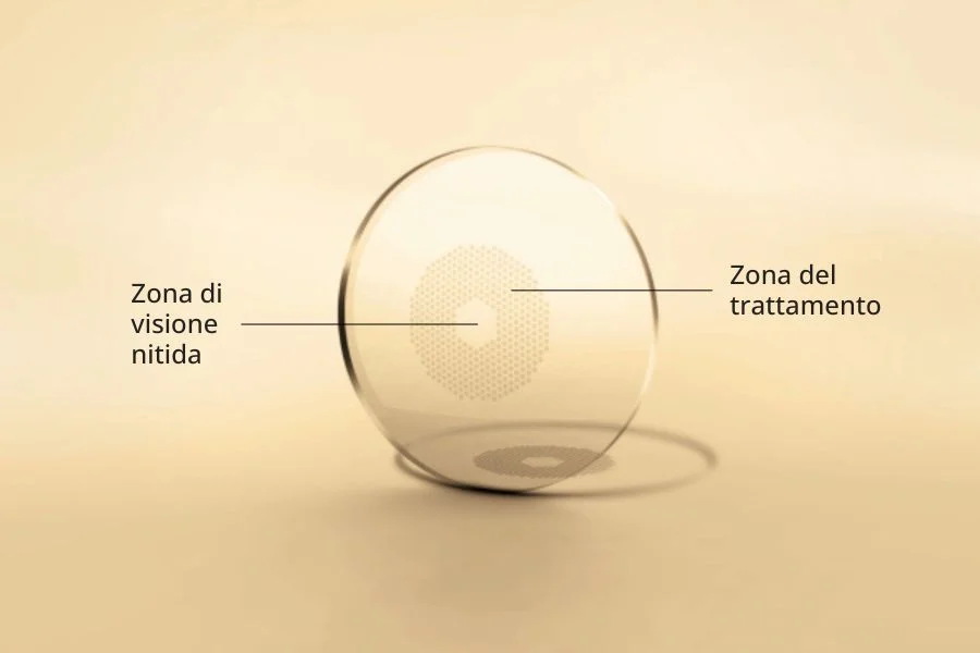miyosmart com'è fatta - ottica Mezzolombardo